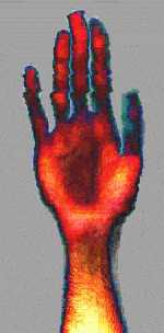 Image of hand